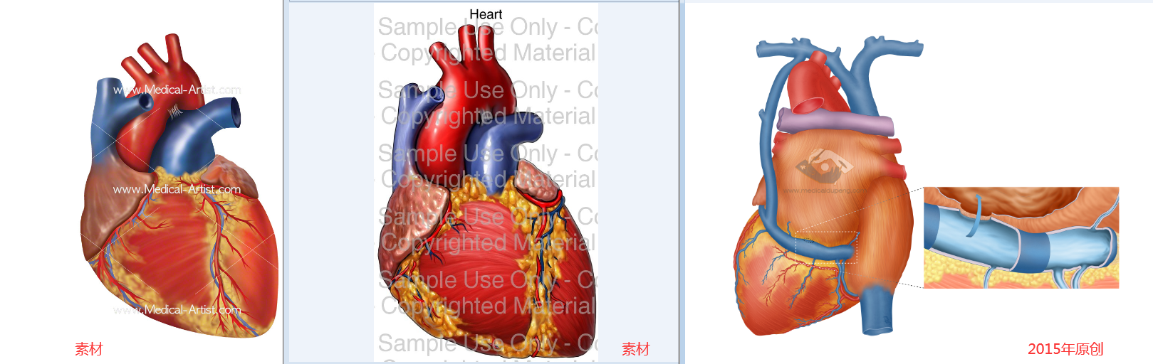 心脏参考图 - 素材和风格 医学插画师-动画师-阿杜的原创生物医学可视化社团作品
